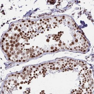 Anti-YTHDF2 antibody produced in rabbit 