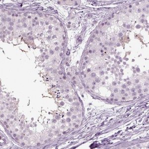 Anti-ZC2HC1C 