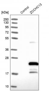 Anti-ZCCHC13 antibody produced in rabbit HPA003382-100UL