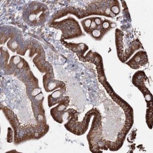 Anti-ZCCHC9 antibody produced in rabbit 