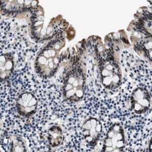 Anti-ZDHHC23 antibody produced in rabbit HPA016808-100UL