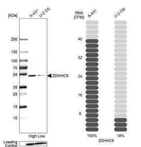 Anti-ZDHHC9 antibody produced in rabbit 