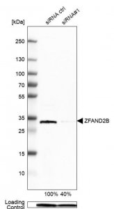 Anti-ZFAND2B antibody produced in rabbit 