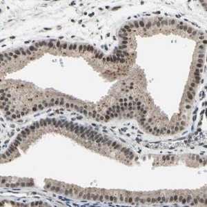 Anti-ZNF174 antibody produced in rabbit 