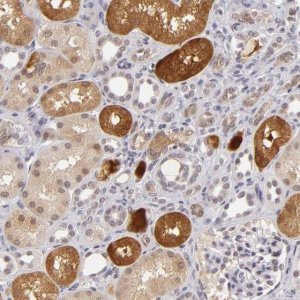 Anti-ZNF205 antibody produced in rabbit HPA001791-100UL