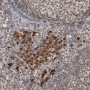 Anti-ZNF24 antibody produced in rabbit 