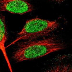 Anti-ZNF24 antibody produced in rabbit 