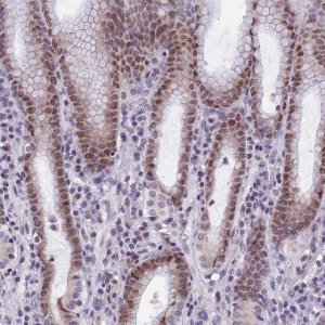 Anti-ZNF317 antibody produced in rabbit 