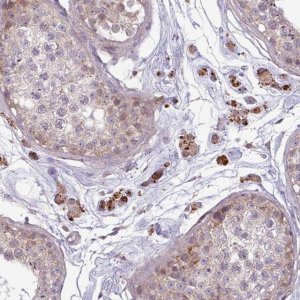 Anti-ZNF35 antibody produced in rabbit 