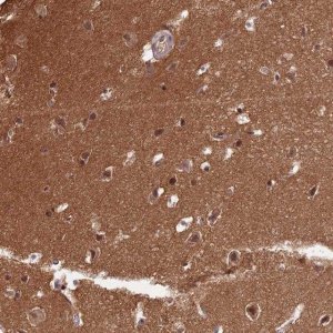 Anti-ZNF436 antibody produced in rabbit HPA043817-100UL