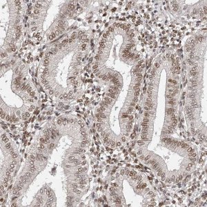 Anti-ZNF503 antibody produced in rabbit 