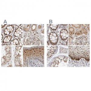 Anti-ZNF521 antibody produced in rabbit 