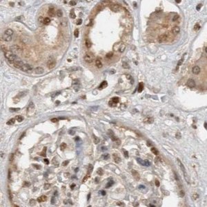 Anti-ZNF521 antibody produced in rabbit 