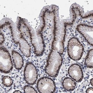 Anti-ZNF529 antibody produced in rabbit 