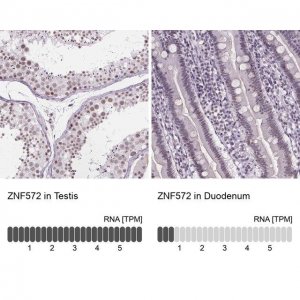 Anti-ZNF572 antibody produced in rabbit 