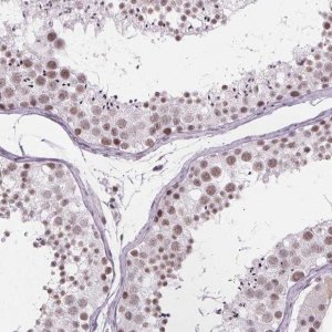 Anti-ZNF572 antibody produced in rabbit 