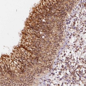 Anti-ZNF580 antibody produced in rabbit 