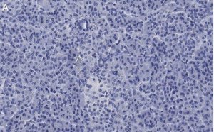 Anti-ZNF598 Antibody, clone 3N7, ZooMAb� Rabbit Monoclonal 