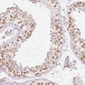 Anti-ZNF610 antibody produced in rabbit 