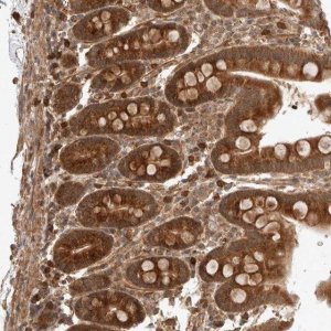 Anti-ZNF649 antibody produced in rabbit 