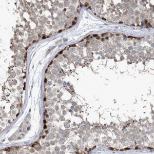 Anti-ZNF654 antibody produced in rabbit HPA036173-100UL