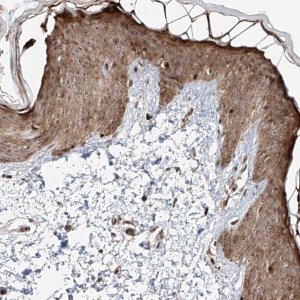 Anti-ZNF710 antibody produced in rabbit 
