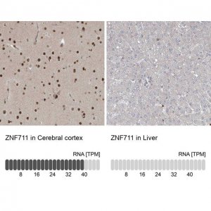 Anti-ZNF711 antibody produced in rabbit 