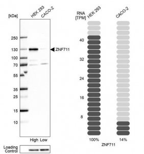 Anti-ZNF711 antibody produced in rabbit 