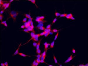 Anti-ZNF746 antibody produced in rabbit SAB4200530-200UL