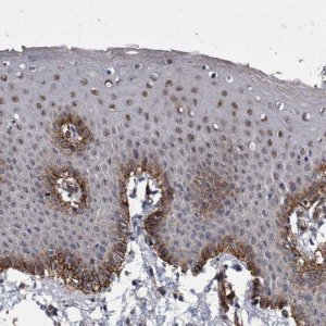 Anti-ZNF750 antibody produced in rabbit 
