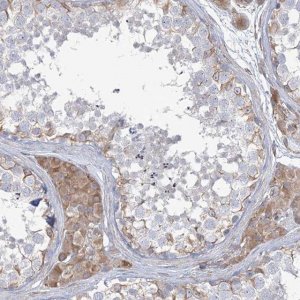 Anti-ZNF821 antibody produced in rabbit 