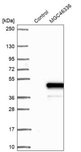 Anti-ZNF843 antibody produced in rabbit HPA030911-100UL