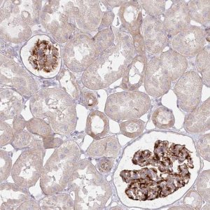 Anti-ZNF843 antibody produced in rabbit HPA030911-100UL