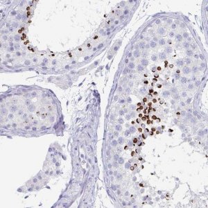 Anti-ZPBP antibody produced in rabbit 