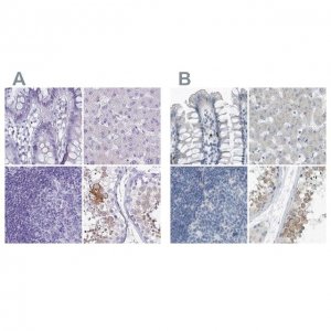 Anti-ZPBP2 antibody produced in rabbit 