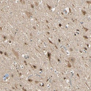 Anti-ZSCAN12 antibody produced in rabbit HPA006637-100UL