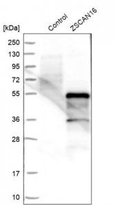 Anti-ZSCAN16 antibody produced in rabbit HPA007290-100UL