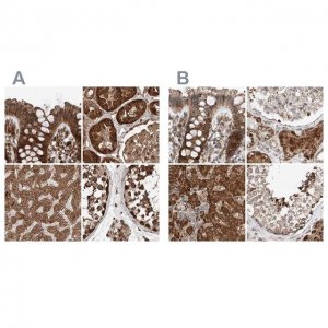 Anti-ZSCAN29 antibody produced in rabbit 