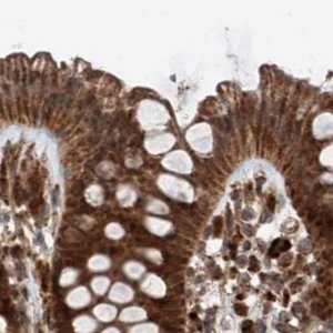 Anti-ZSCAN29 antibody produced in rabbit 