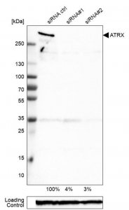 Monoclonal Anti-ATRX antibody produced in mouse 