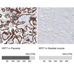 Monoclonal Anti-KRT7 antibody produced in mouse AMAB91530-100UL