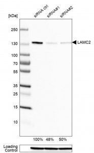 Monoclonal Anti-LAMC2 antibody produced in mouse 
