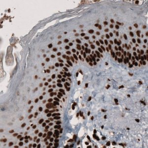 Monoclonal Anti-PARP1 