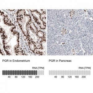 Monoclonal Anti-PGR antibody produced in mouse AMAB91529-100UL