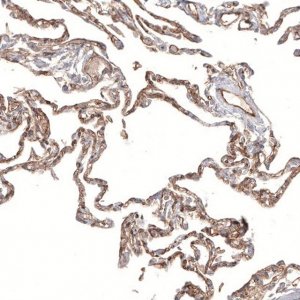 Monoclonal Anti-PIEZO1 antibody produced in mouse AMAB91589-100UL