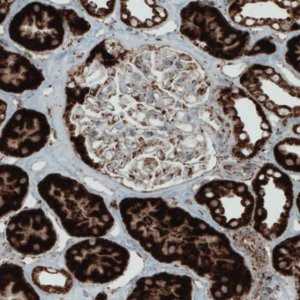 Monoclonal Anti-SDHB antibody produced in mouse 