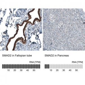 Monoclonal Anti-SMAD2 antibody produced in mouse AMAB91520-100UL