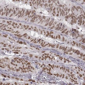 Monoclonal Anti-SNAI1 antibody produced in mouse 