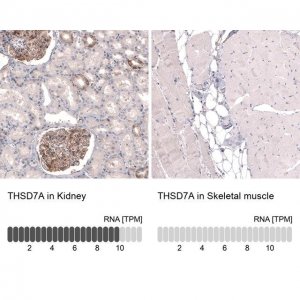 Monoclonal Anti-THSD7A antibody produced in mouse 