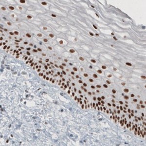 Monoclonal Anti-TLE3 antibody produced in mouse 